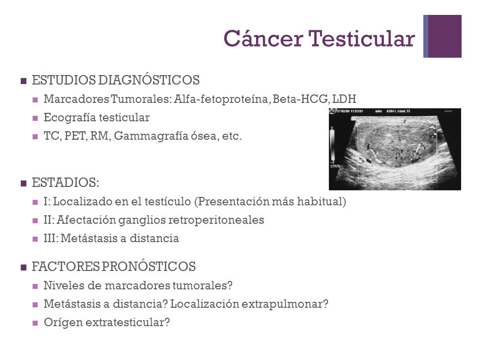 Metastasis del cancer de testiculo